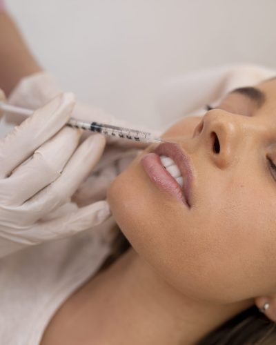 mujer-de-cerca-recibiendo-relleno-de-labios-con-inyeccion