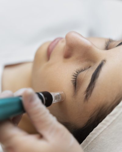persona-que-recibe-un-tratamiento-de-belleza-con-microagujas